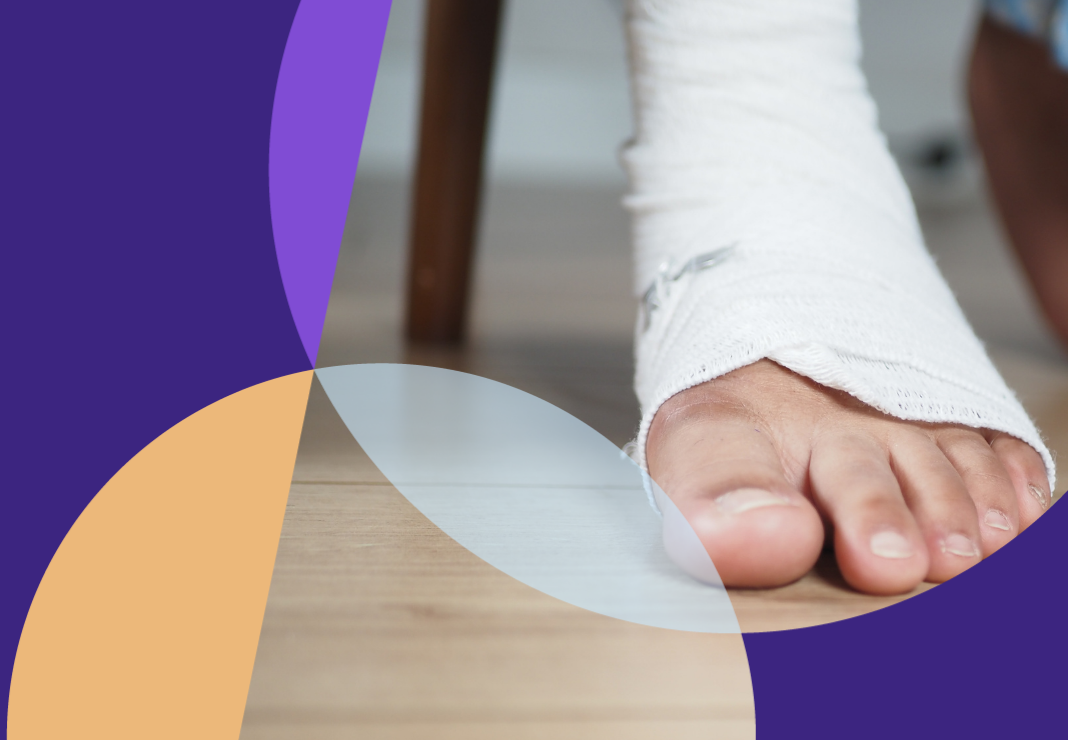 Foot in bandage for diabetic foot surgery